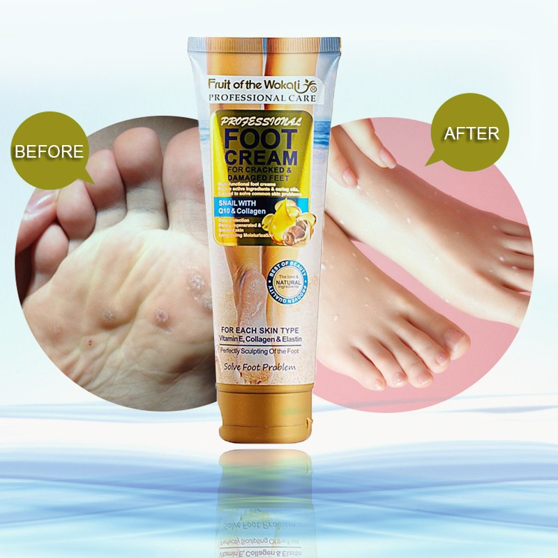 WOKALI  Крем для ног FOOT CREAM Snail Q10 & Collagen для потрескавшейся кожи УЛИТКА с Q10 и КОЛЛАГЕН  130мл  (WKL-489)